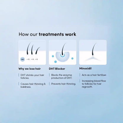 MinoxyFin Active Hair Regrowth Spray